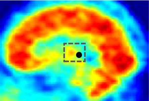 Typical location of center of mass of brain SPECT image