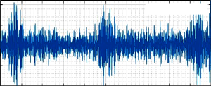 Abnormal FPCG signal