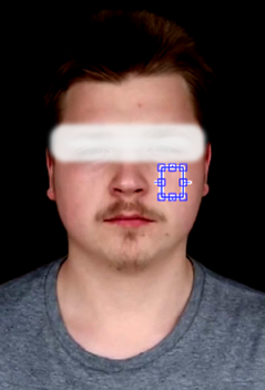 Selected cheek RoI